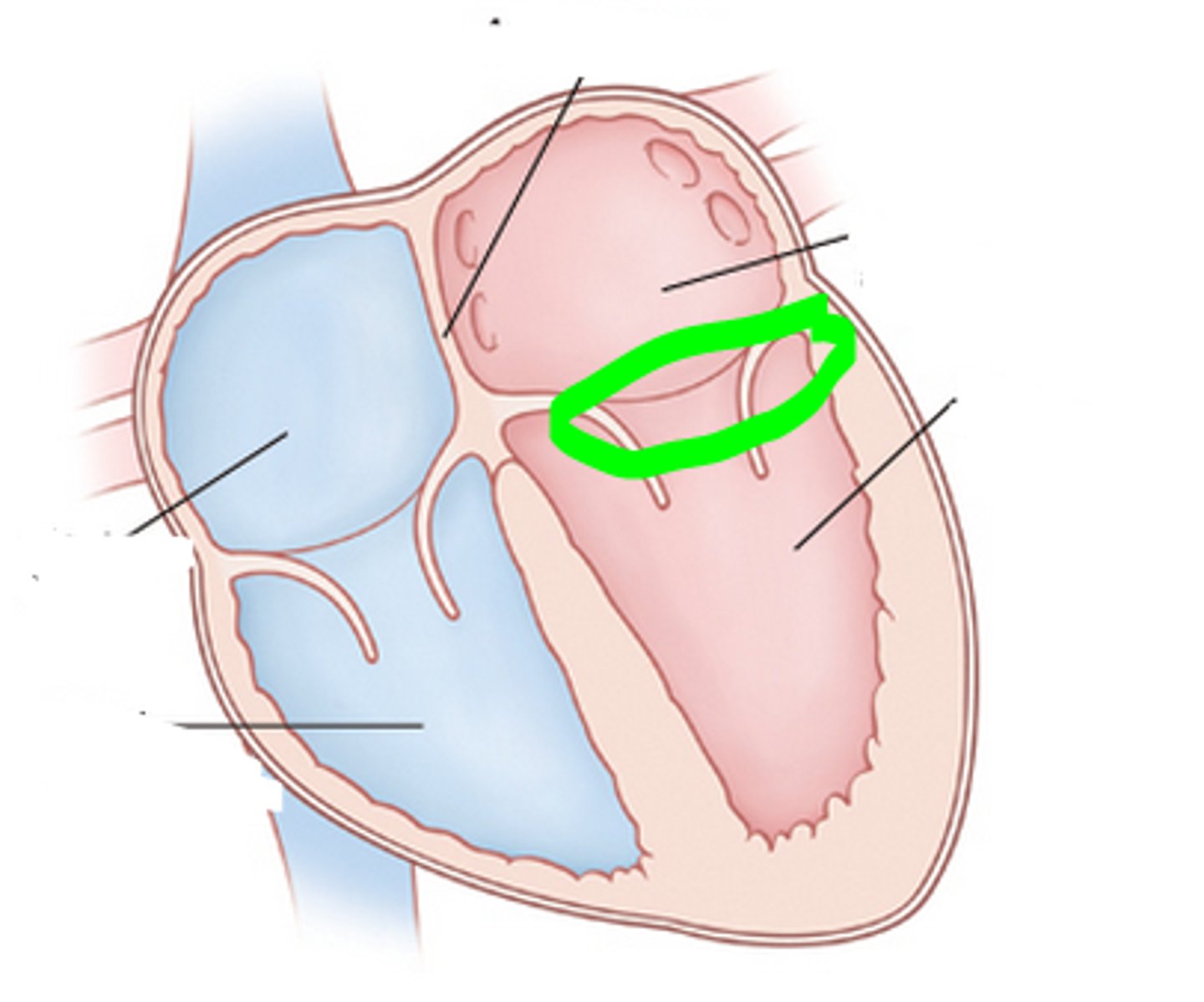 <p>Space </p><p>reveals hole into left ventricle</p><p>will be seen sideways</p>
