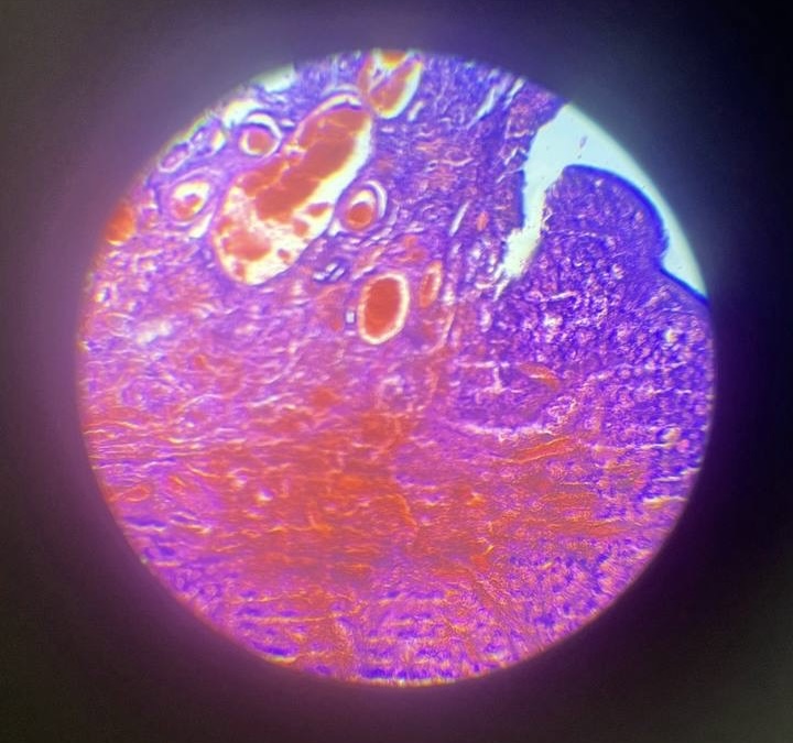 <p>Яєчник </p>