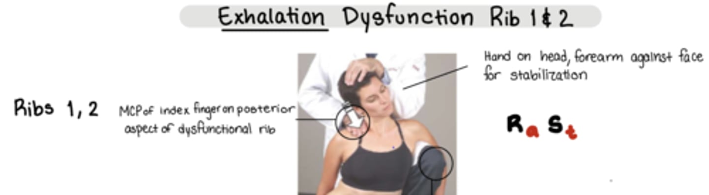 <p>Ra St</p><p>Pt is SEATED</p><p>Physicians leg OPPOSITE of the SD on table to stabilize</p><p>one hand on pt head, forearm against head for stabilization</p><p>Thrust:</p><p>MCP of index finger on POSTERIOR aspect of dysfunctional rib - thrust @ end of exhalation</p>