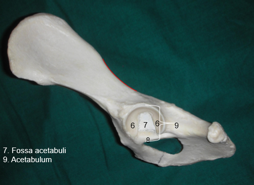 <p>Höftleden, vilken typ?</p>