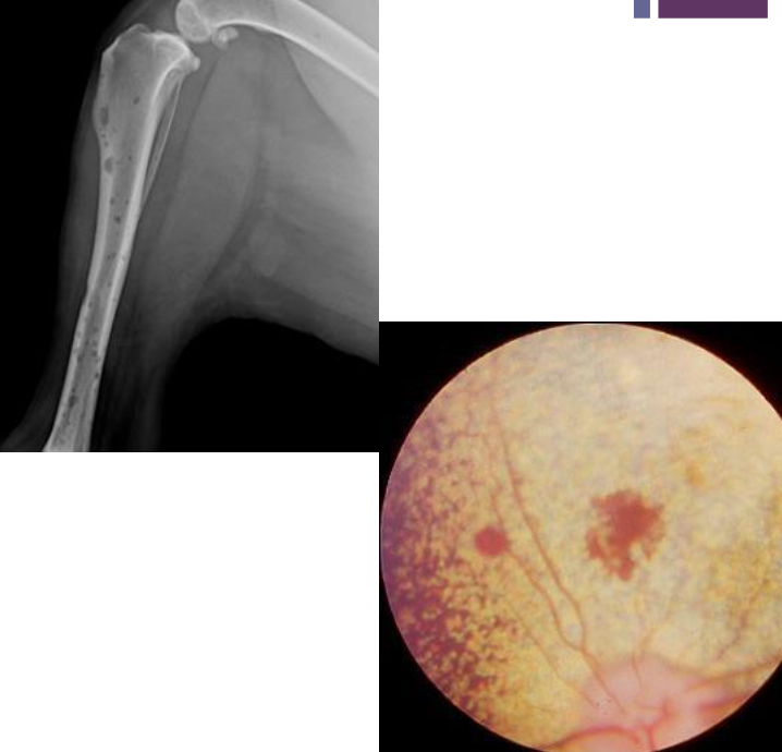<p>CBC, serum biochem, UA (PT/PTT if signs of bleeding)<br><br>fundoscopic exam<br><br>imaging:<br>-thorax (rads/CT)<br>-abdomen (rads, US, CT- <strong>especially in cats since they tend to have the visceral form</strong>)<br>-skeleton (CT, rads)<br><br>these diagnostics are important for diagnosis, tx, and monitoring</p>