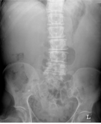 <p>What is this and what type of scan </p>