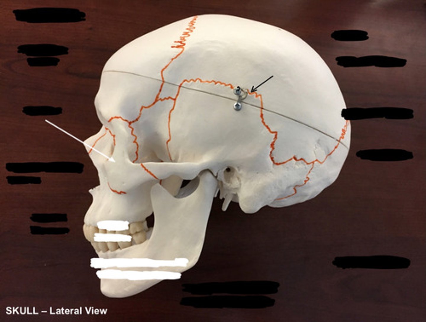 <p>What structure is pointed to here?</p>