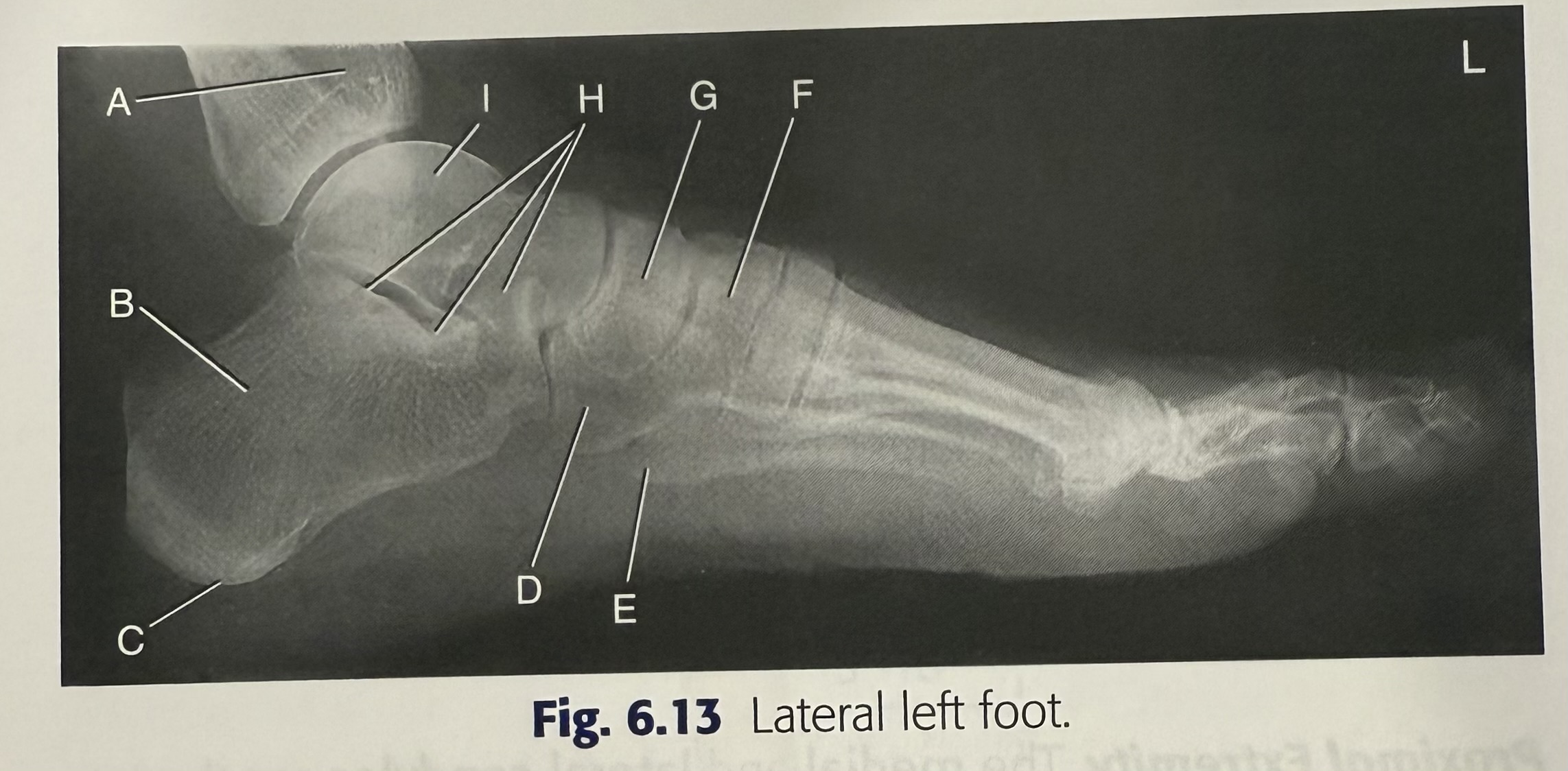 <p>F</p>