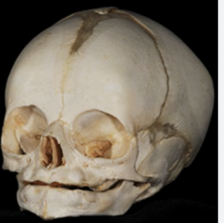 what kind of skull is this 