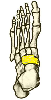 Name the highlighted foot bone