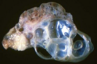 <p>What is this condition? What are associated clinical signs?</p>