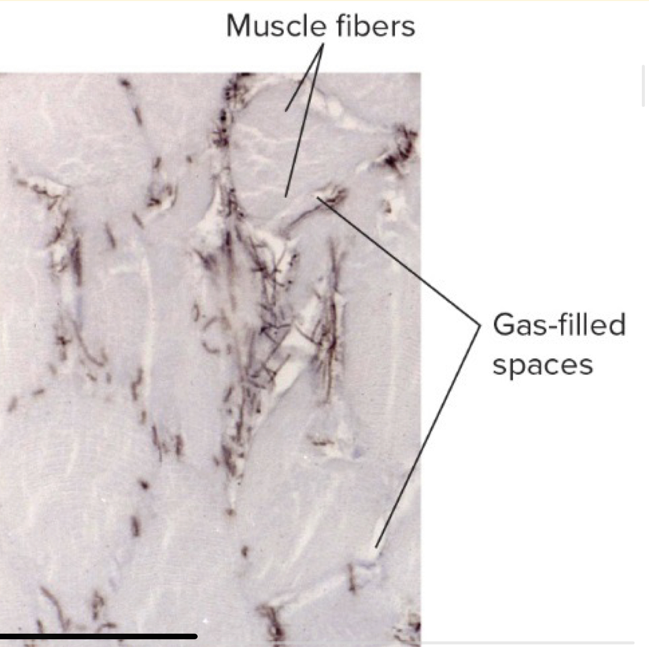 <p></p><ul><li><p>Most frequent clostridia involved in soft tissue and wound infections</p></li><li><p>Found in GI tract of multiple sclerosis patients</p></li><li><p>Found in soil, human skin, intestine, and vagina</p></li></ul>