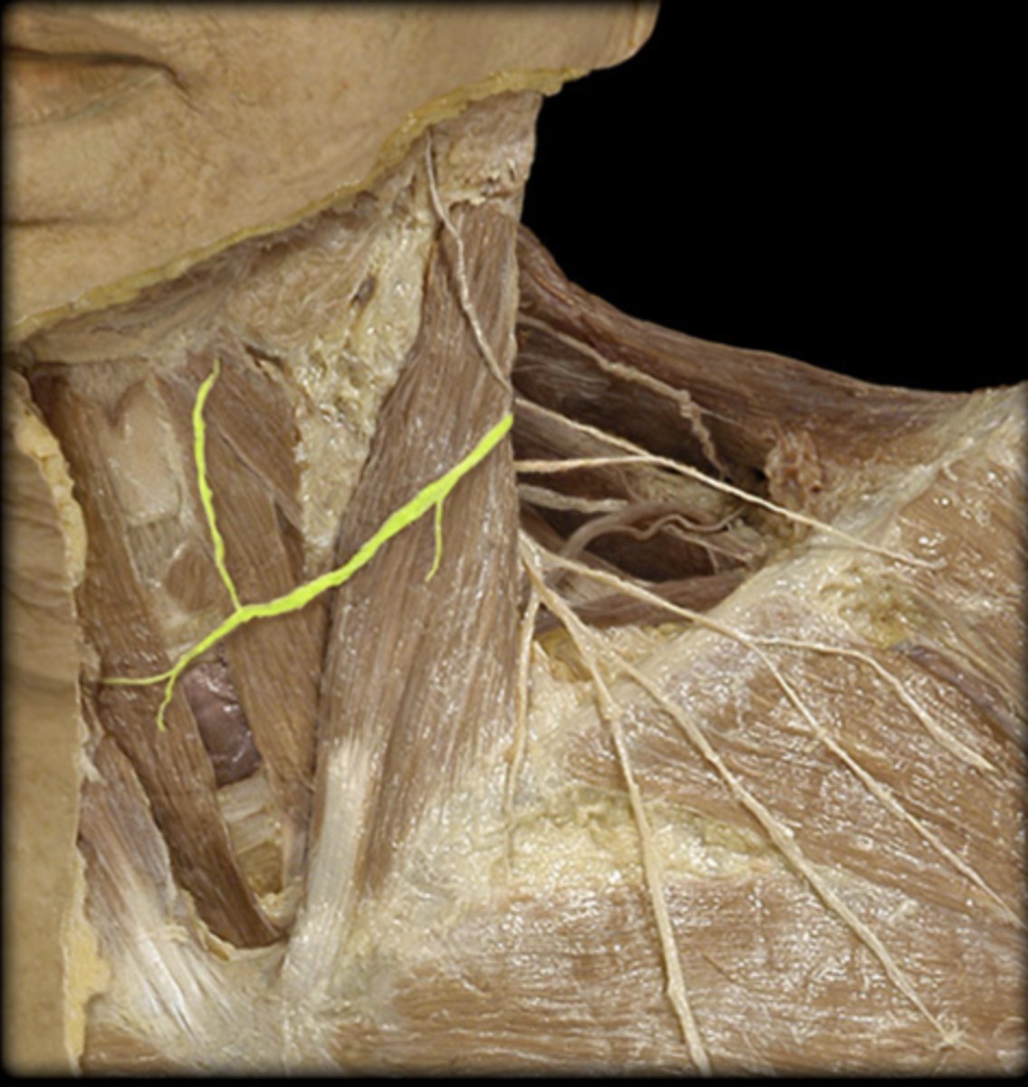 <p><em>identify the structure</em></p>