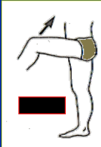 <p>What Movement is occurring?</p>