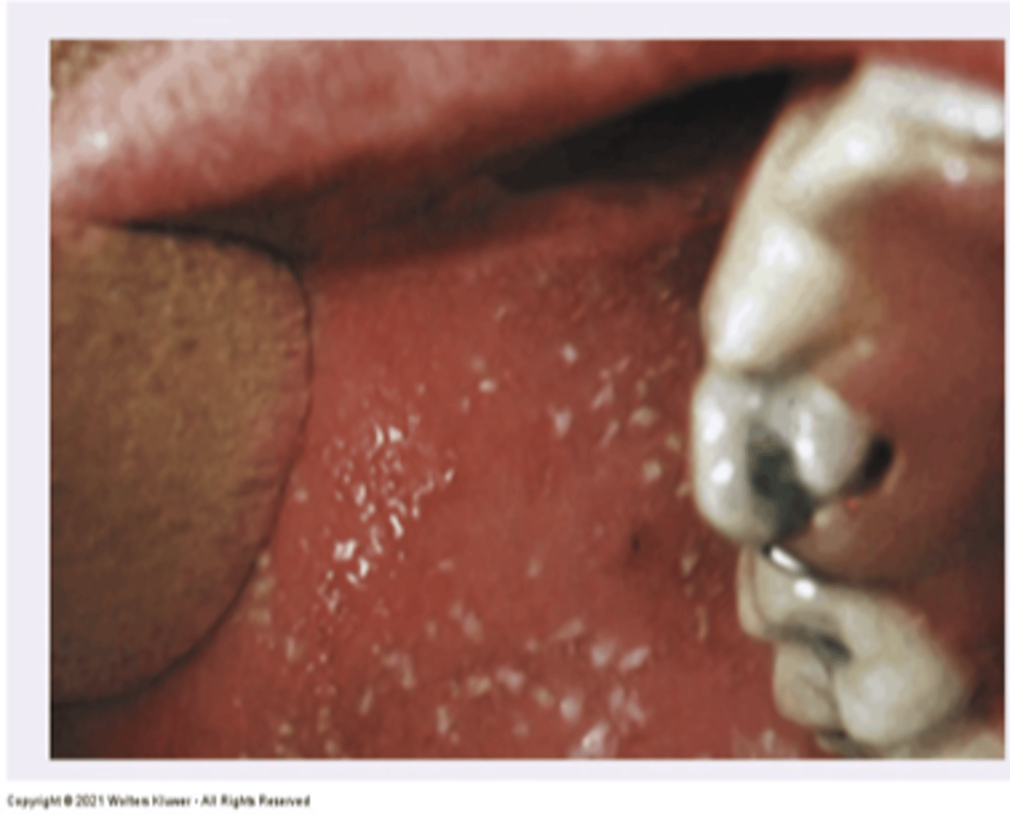 <p>Diagnosis?</p>
