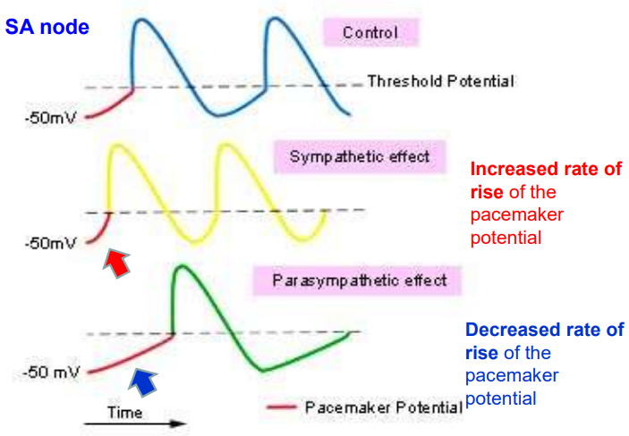 <p>A rate in rise of the pacemaker potential. </p>