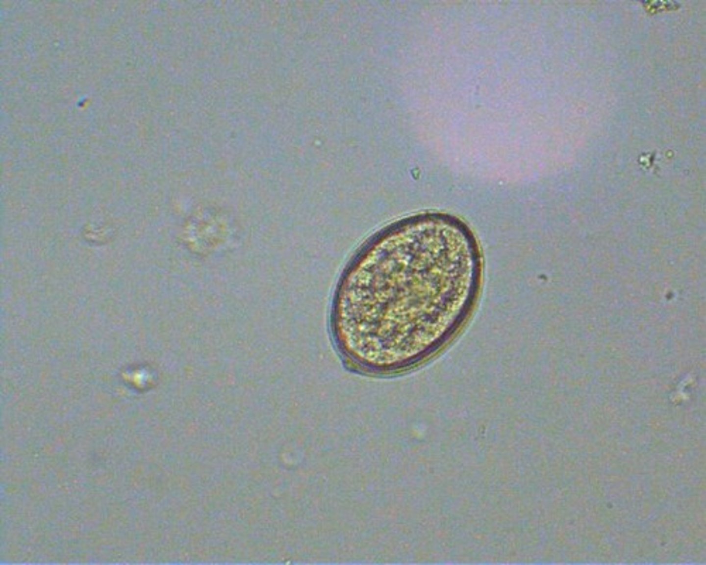 <p>abopercular end has knob</p>