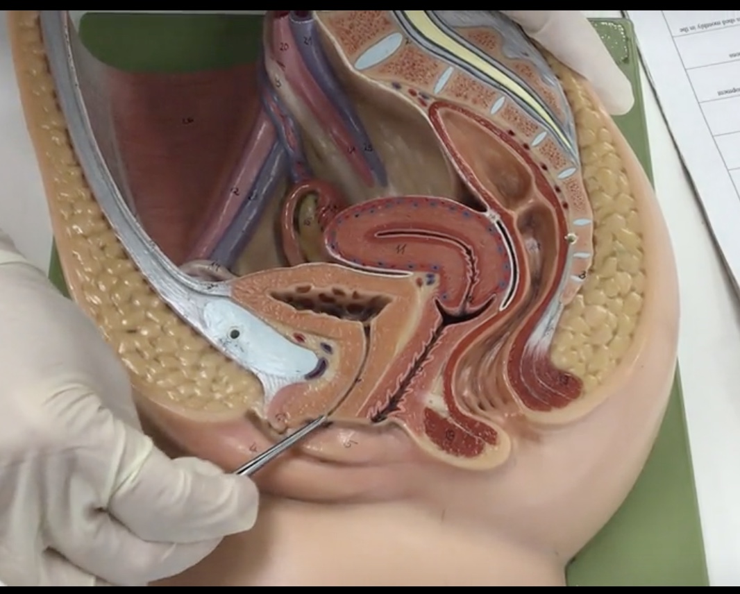 <p>Description: Exit of urethra anterior to the vaginal orifice</p><p>Relationship: Exit for urine</p>