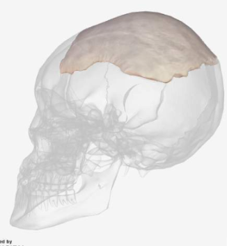 <p>BQ:WHAT IS THIS TYPE OF BONE?</p><p>-layer of spongy bone between two layers of this compact bone.</p><p>-They have marrow but no marrow cavity</p><p>*left parietal bone</p>