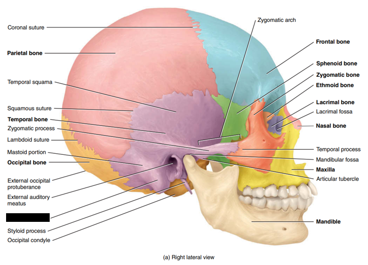 <p>State and identify what part of the cranial bone is being pointed out and censored. (hint: process)</p>