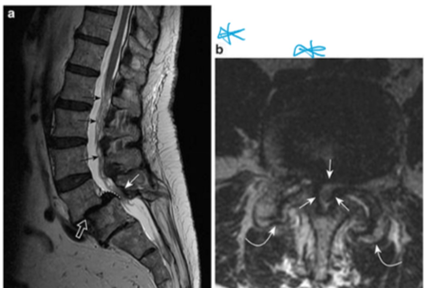 <p>Name the pathology</p>