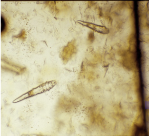 <p>What type of mite is this and what is it called?</p>