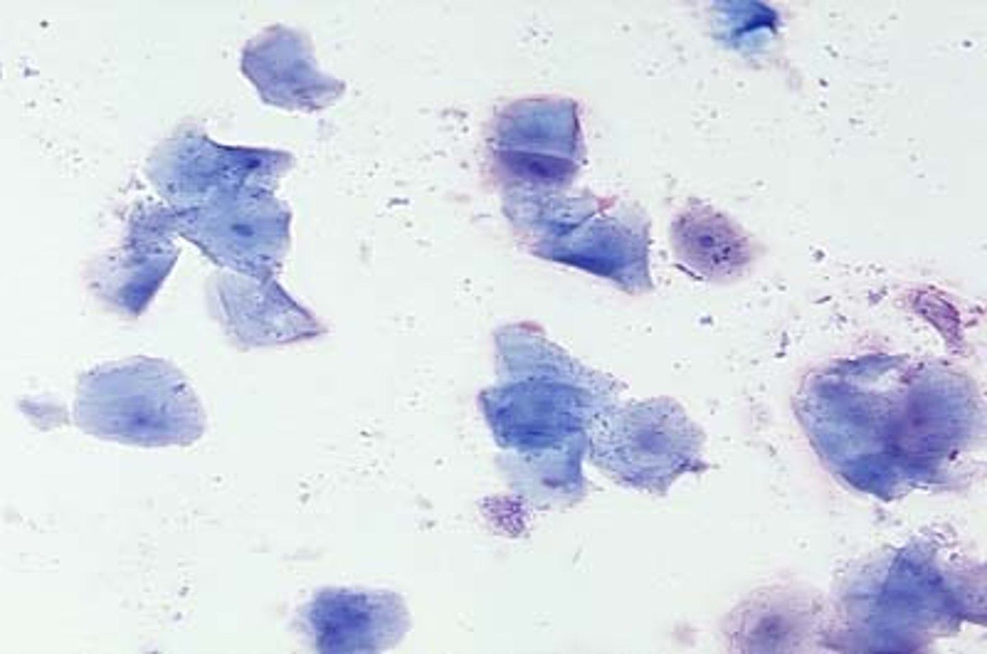 <p>Cornified squamous epithelial cells</p>