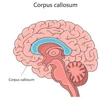 <p>corpus callosum</p>