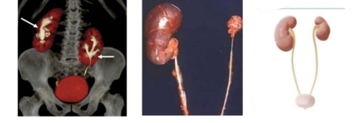 <p>identify then define</p>