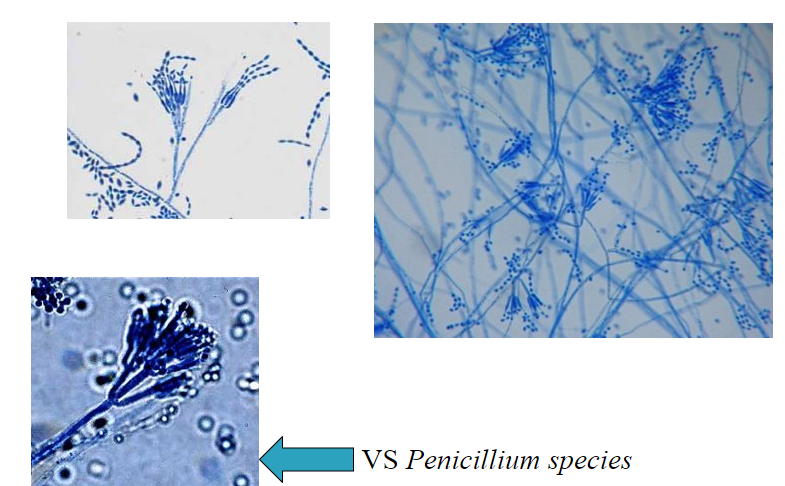 <p>sinusitis, eye infns, EC, nephritis, cutaneous,… in i-compromised pts</p><p></p><p>cottony pink, white, yellow</p><p></p><p>looks like Penicillium, but phialides are not parallel and taper, more delicate</p>