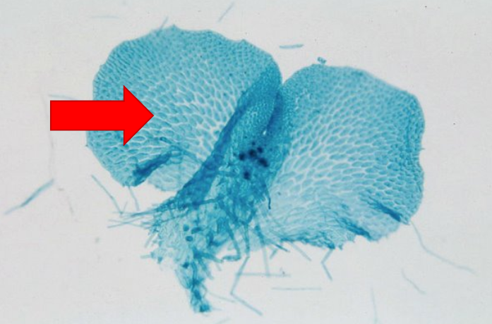 <p>What structure does this point to?</p><p>A) Moss Gametophyte</p><p>B) Moss Sporophyte</p><p>C) Fern Gametophyte</p><p>D) Fern Sporophyte</p>