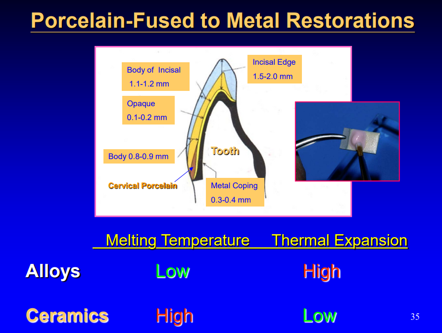 <p>melting temp for alloy: low </p><p>melting temp for ceramic: high </p><p>thermal expansion for alloy: high </p><p>thermal expansion for ceramic: low </p>