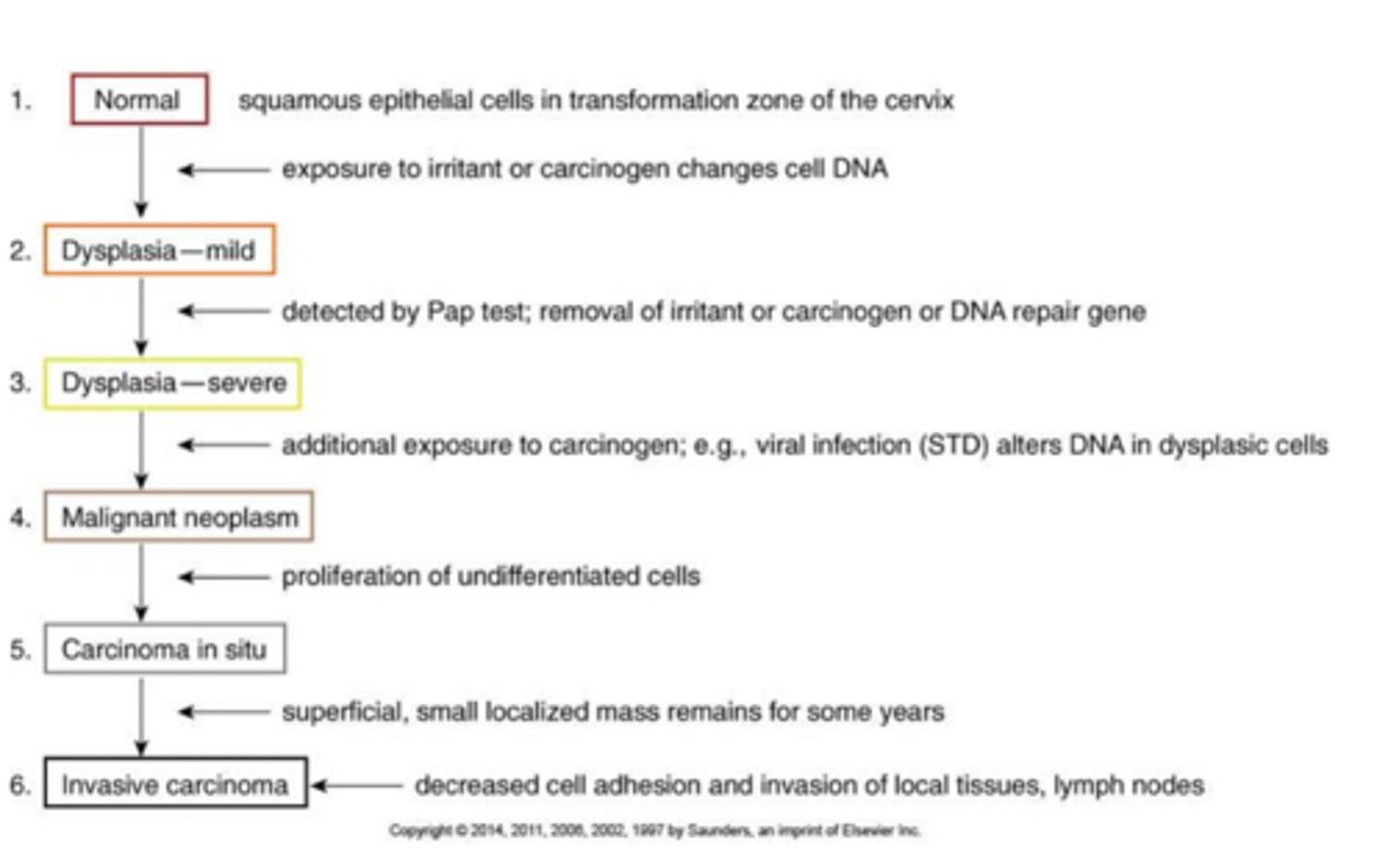 <p>squamous epithelial cells in transformation zone are exposed to irritant or carcinogen and changes cell DNA.. detected by Pap smear and are removed. additional exposure or a viral infection alters DNA in dysplasic cells and undifferentiated cells start proliferating. a superficial, small localized mass remains for years and finally invades with decreased cell adhesion and invasion of local tissues and lymph nodes</p>