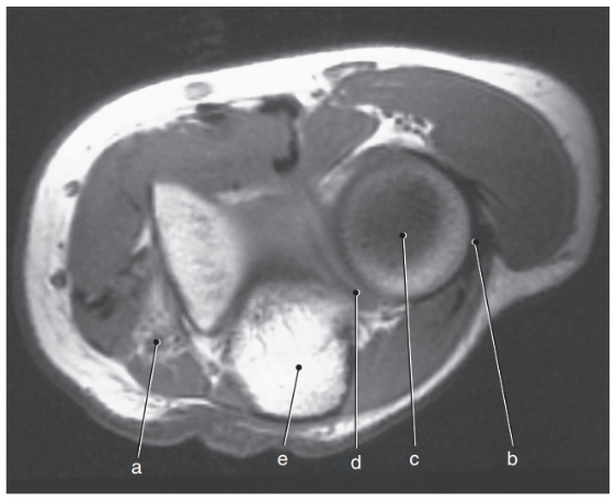 <p>What is letter e ?</p>