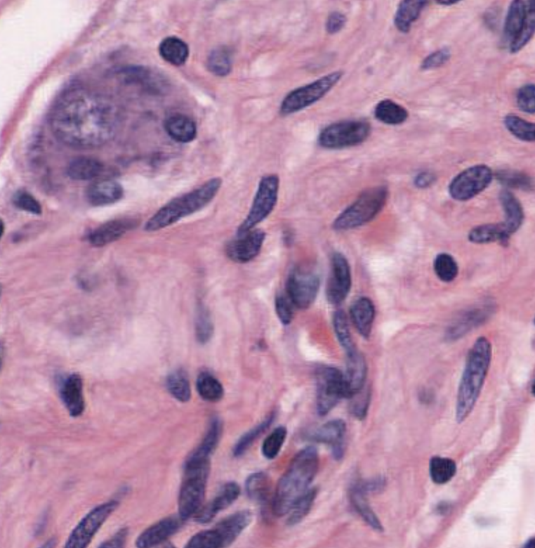 <p>which ganglion</p>