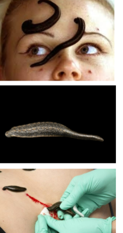 <p>This organism is a sucker.</p>