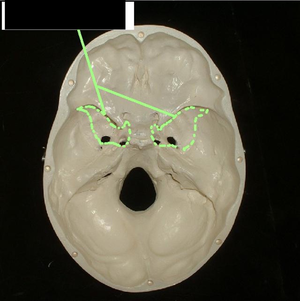 <p>behind the eye socket; concave.</p>