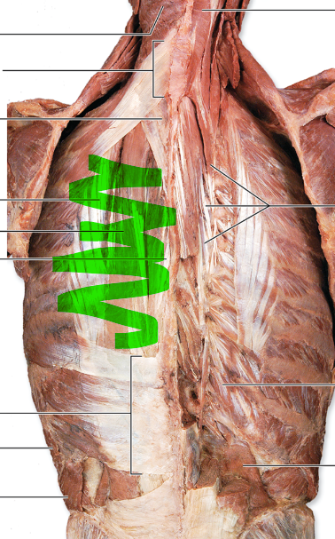 <p>Erector Spinae</p>