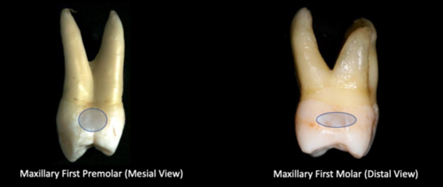 <p>What is unique about the mesial surface of maxillary 1st premolar and distal surface of maxillary 1st molar?</p>