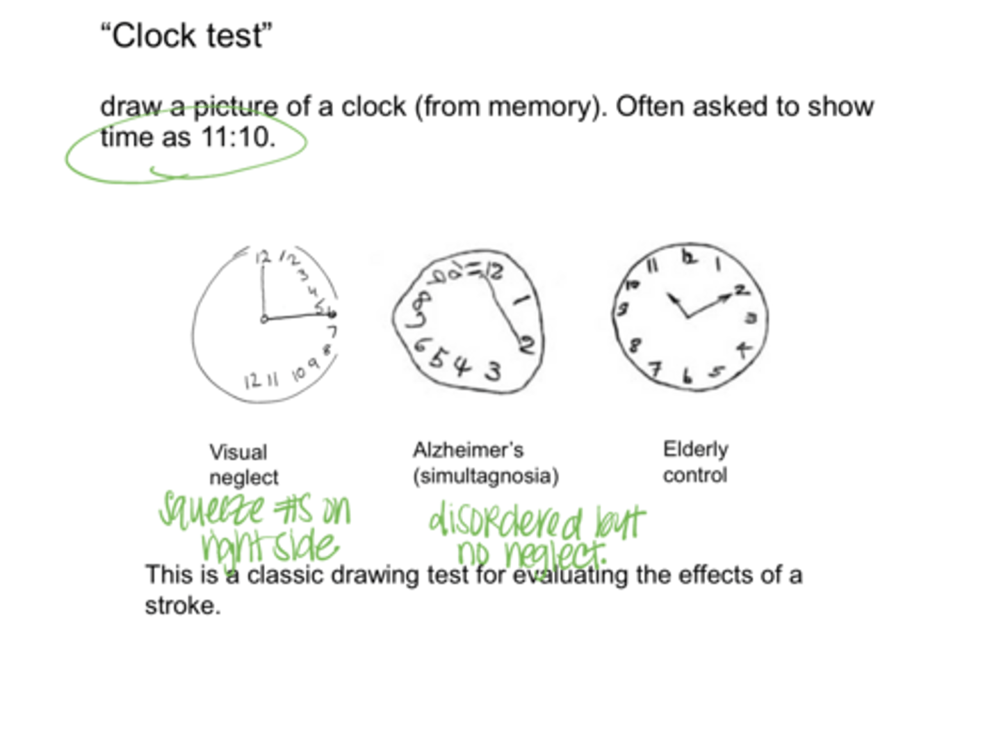 <p>Clock Test w/ Hemifield Neglect Syndrome (Pic)</p>
