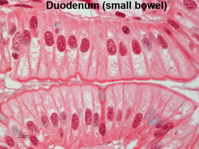 <p>What type of epithelium is this?</p>