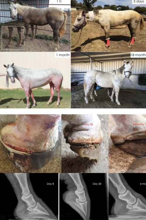 <ul><li><p>1st degree: erythema, edema, desquamation</p></li><li><p>2nd degree: vesicles, necrosis, eschar</p></li><li><p>3rd degree: loss of sensation, deep eschar<br>Mortality increases if >50 % of skin affected. Full extent visible within ~14 days</p></li></ul><p></p>