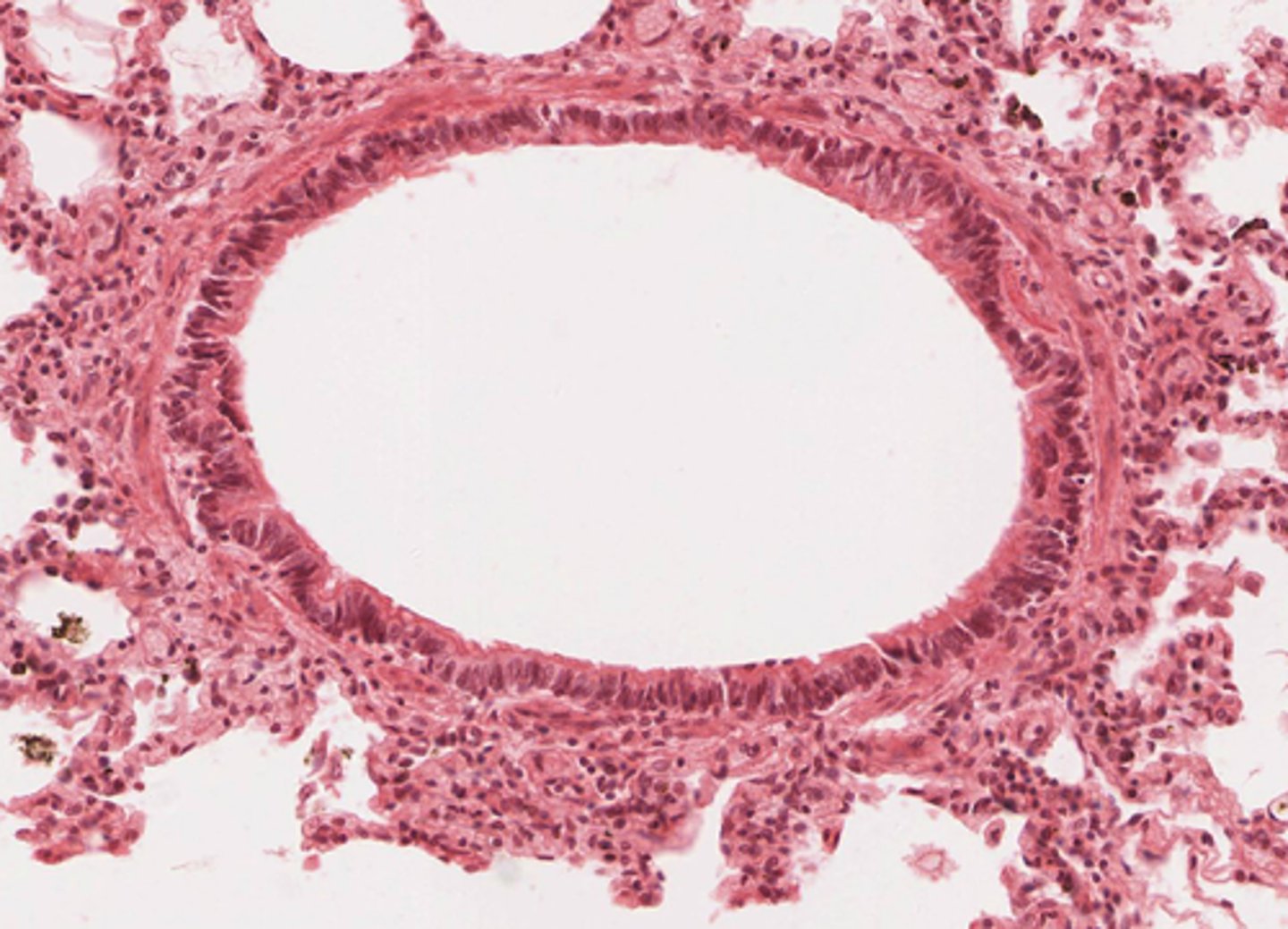 <p>Identify the organ in the micrograph below.</p>