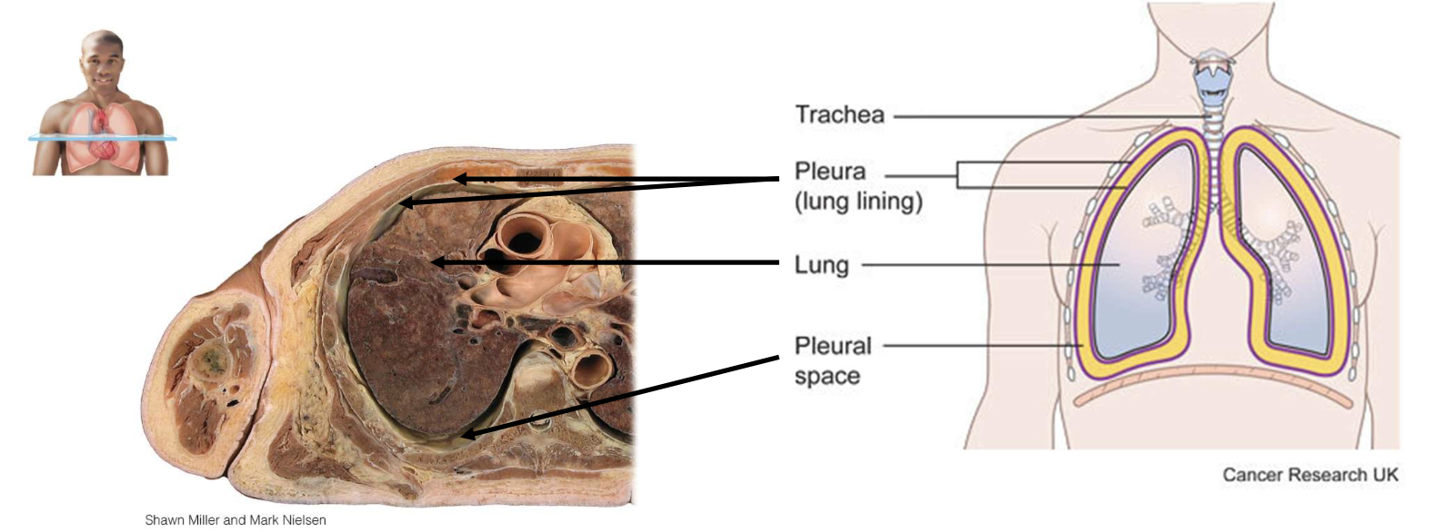 <p>visceral pleura; covering lungs themselves</p>