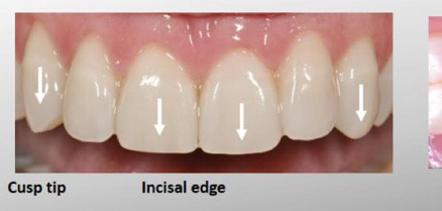 <p>Canines have ____ instead of incisal edge</p>