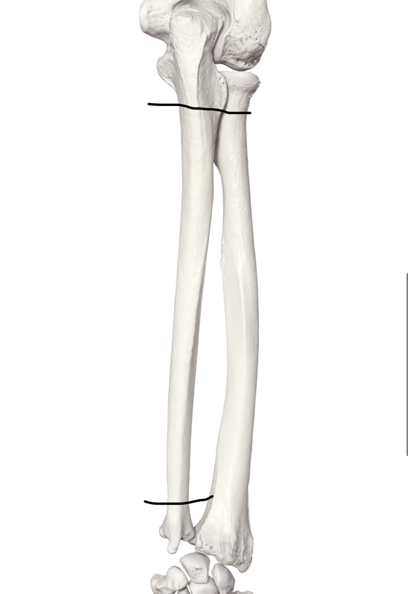 <p>Hoe heet dit deel</p>