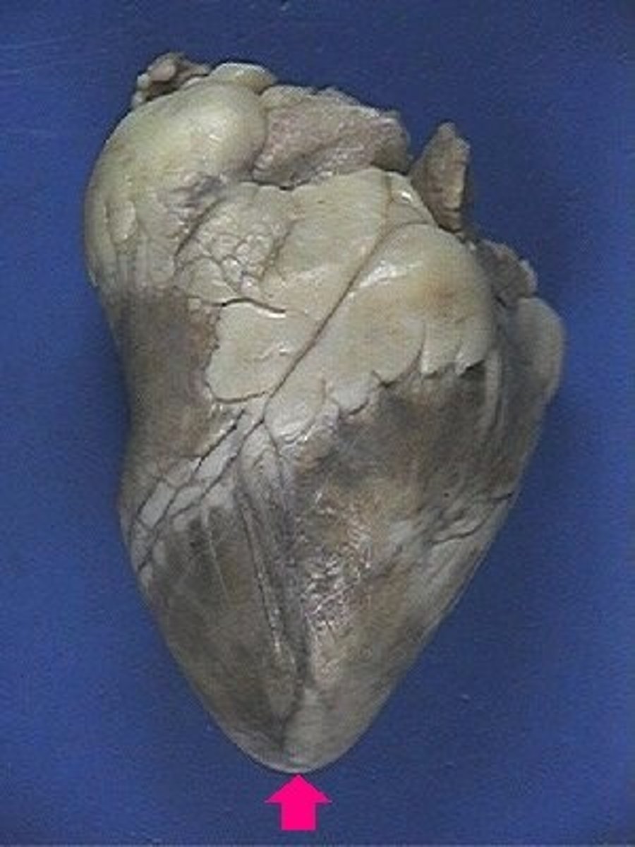 <p>Identify the tip.</p>