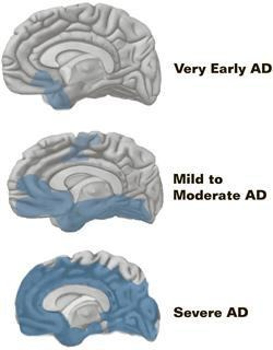 <p>Impaired memory, confusion, changes in behavior, and difficulty with familiar tasks.</p>