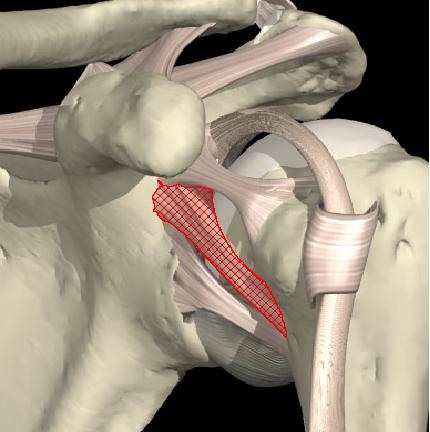 <p>Extends from anterior glenoid margin of the scapula (just inferior to the superior GH ligament) to less tubercle of humerus</p><p>stabilizes the shoulder capsule around ball-and-socket joint and limits external rotation, especially when the arm is in an abducted position</p>