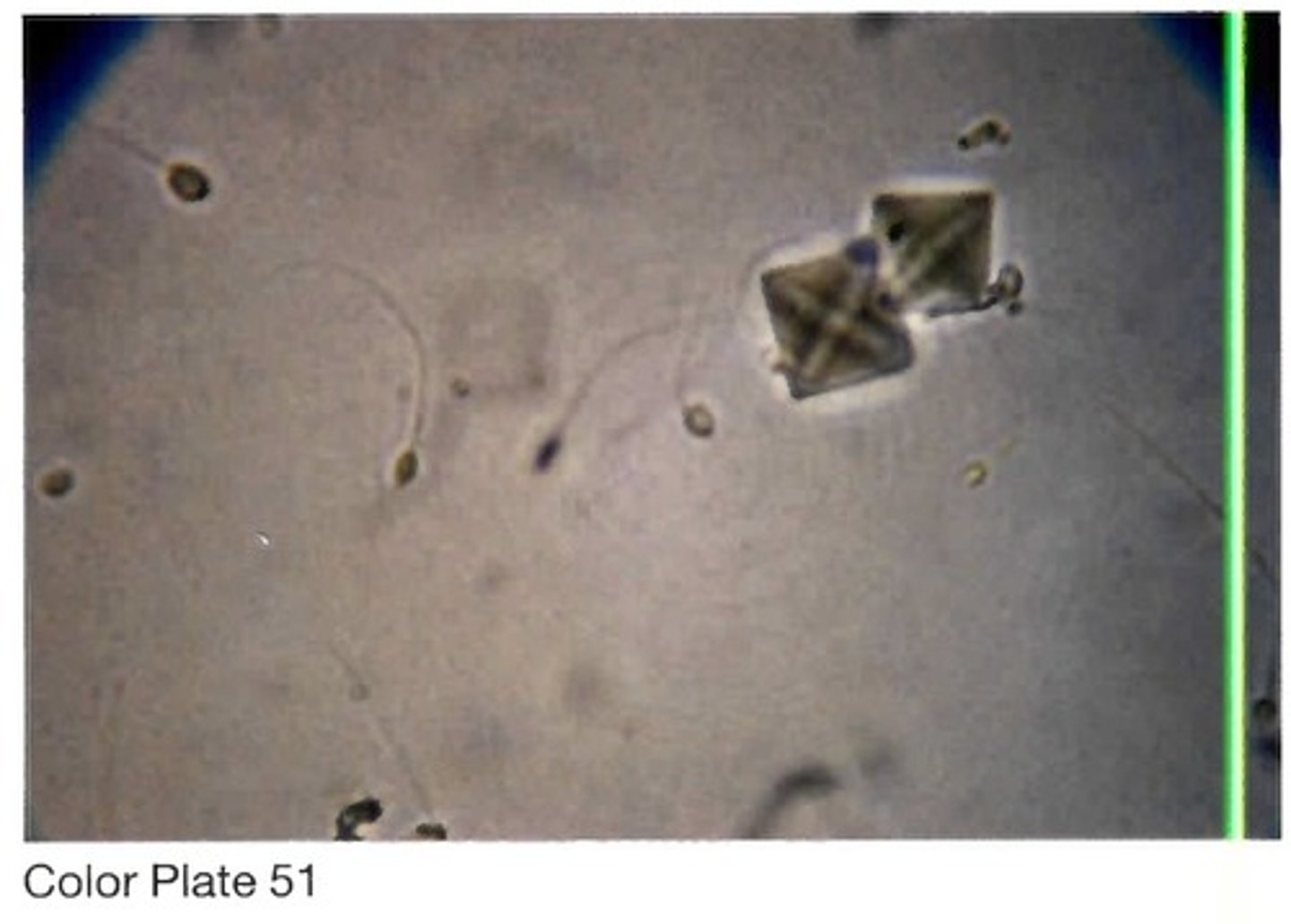 <p>D. Normal sample</p>