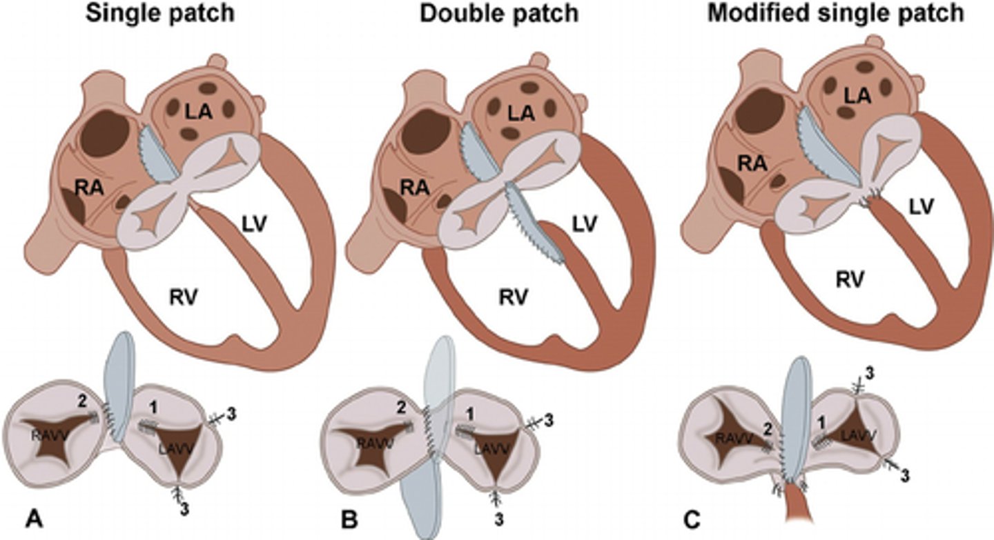 <p>development or persistence of AV valve regurgitation.</p><p>Not uncommon to have mild AV valve regurgitation after repair but anything more than moderate will likely progress over time.</p>