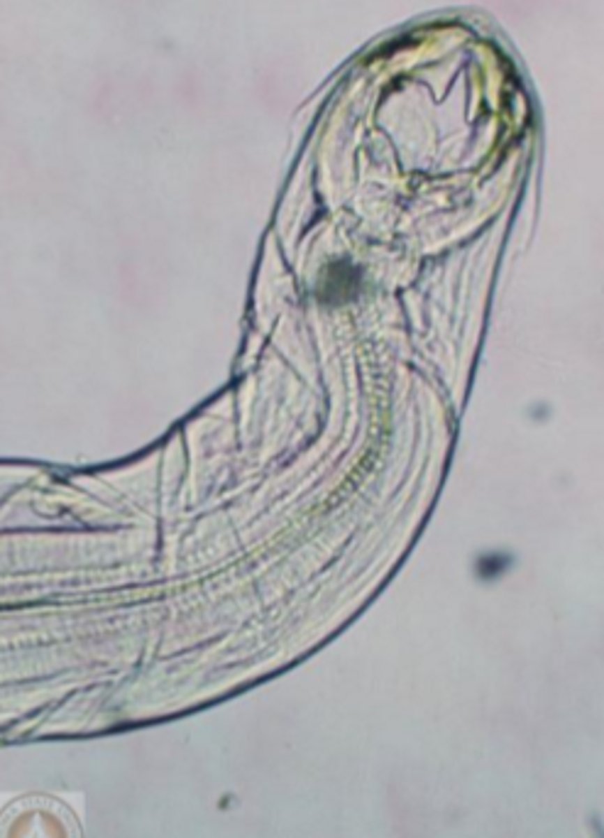 <p>Hookworms</p><p>1 pair of teeth</p>