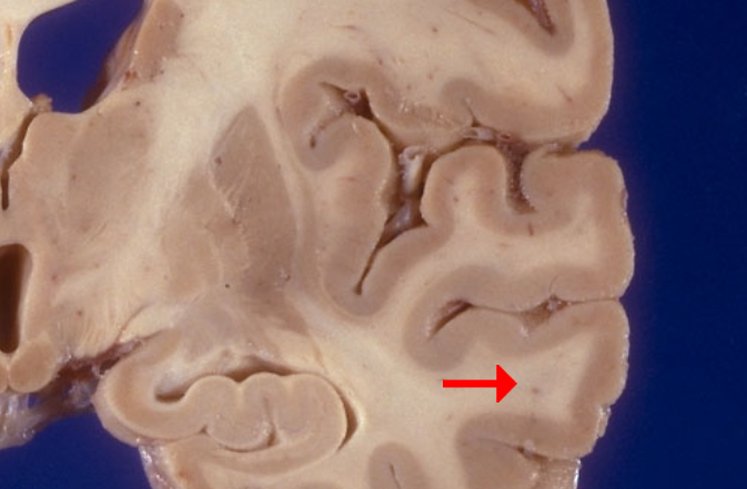 <p>Label this brain structure</p>