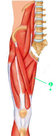 <p><span>Identify the indicated muscle.</span></p>